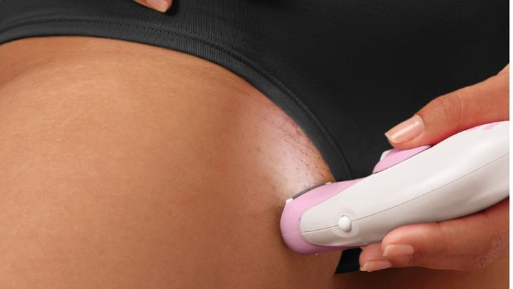 Effortless Hair Removal